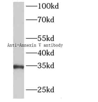 Anti-Annexin V antibody - Click Image to Close